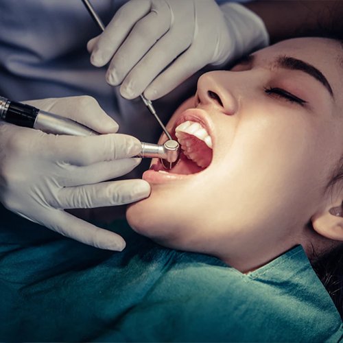 root-canal-treatment